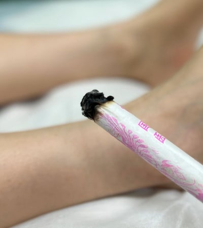 TCM services - Moxibustion